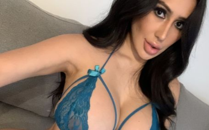 28-years-old-undergoes-surgeries-to-look-like-kim-kardashian