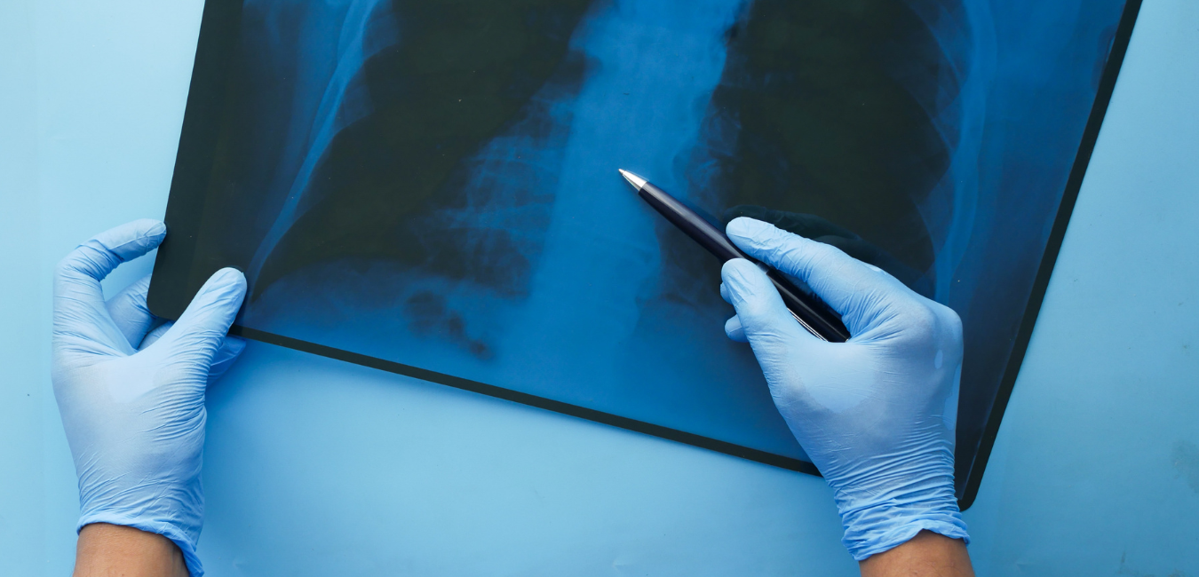 Bone health