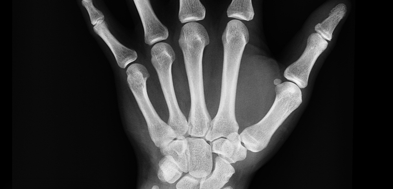 Helps in curing bone related diseases 