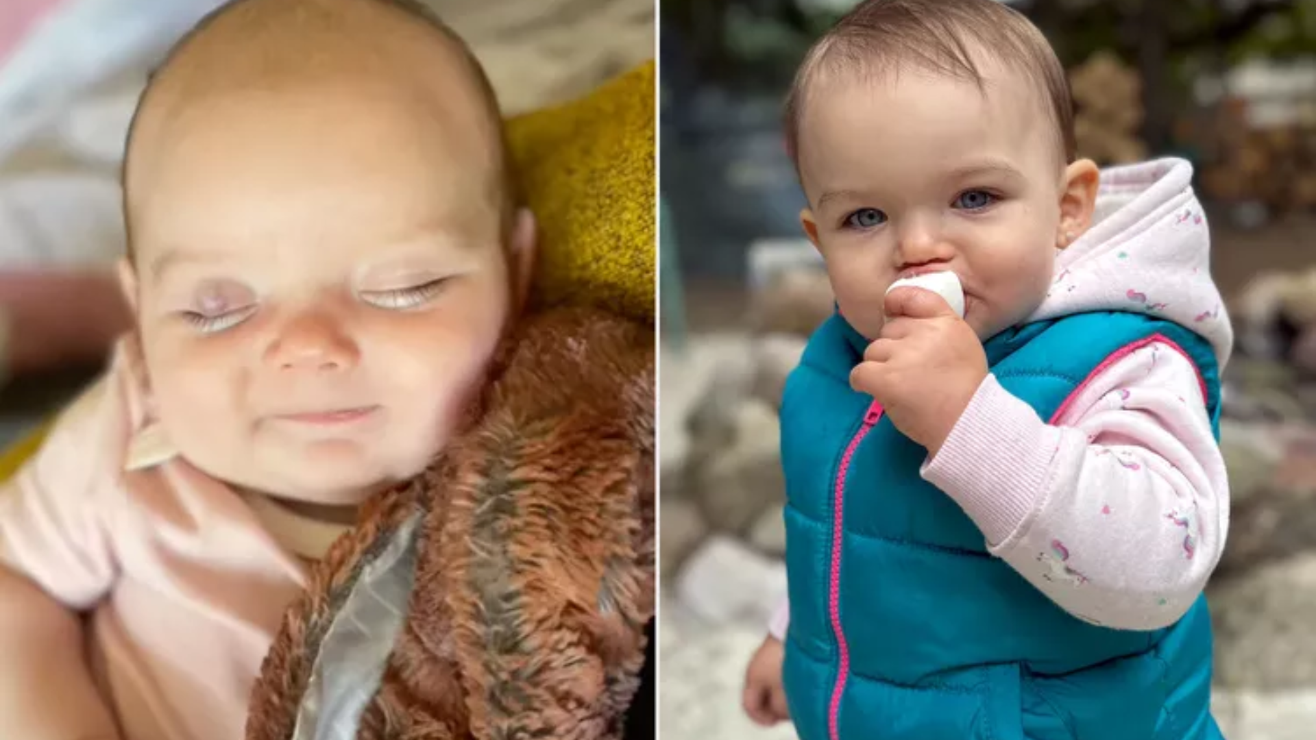 Mom thinks baby has stye, then discovers she's losing eyesight 2 baby2