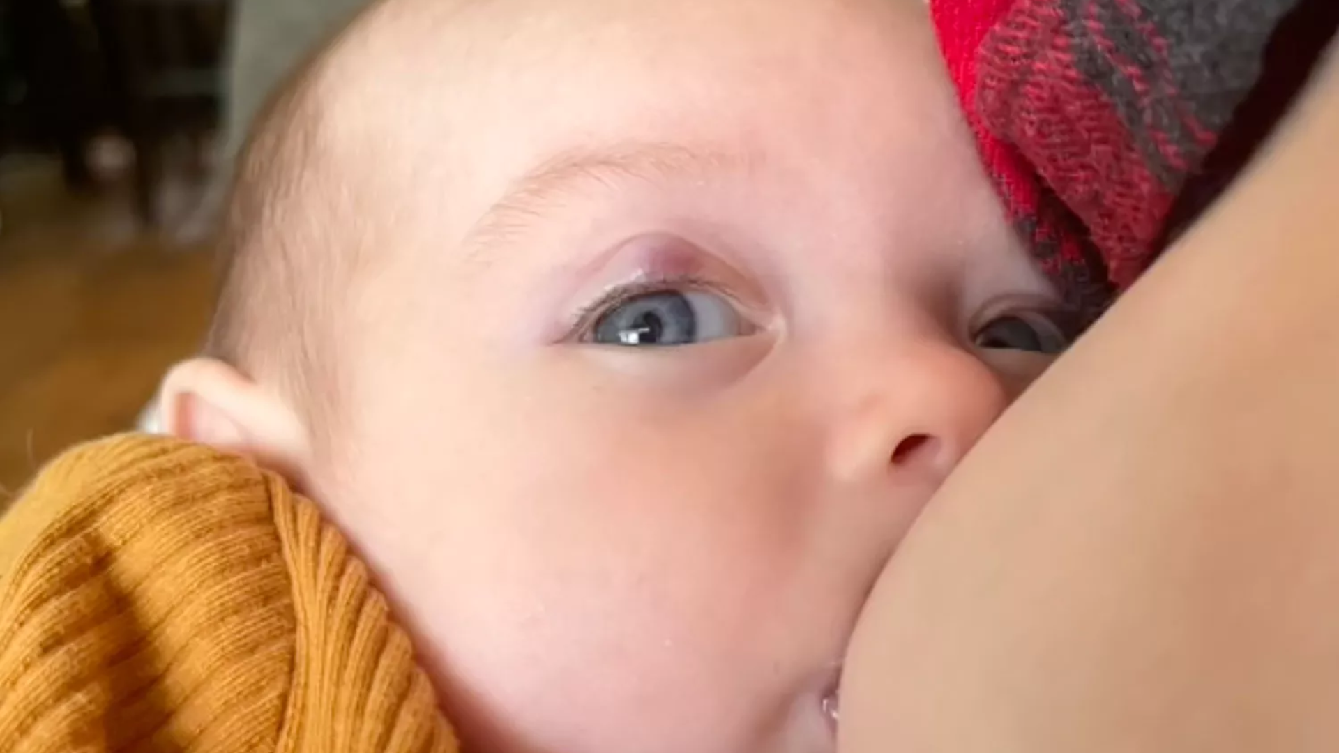 Mom thinks baby has stye, then discovers she's losing eyesight 3 baby4
