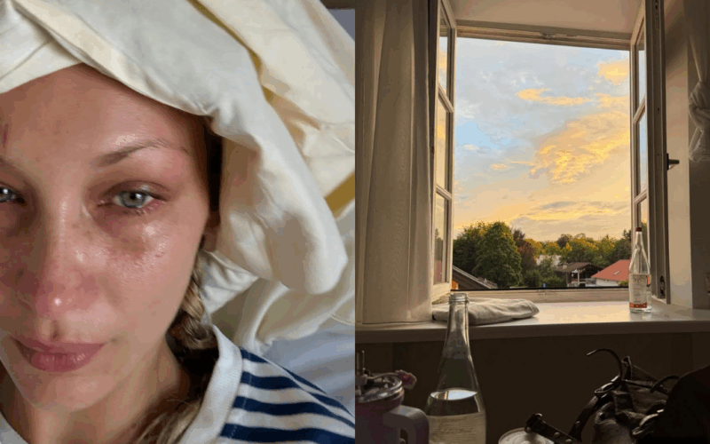 Bella Hadid shares posts from hospital bed